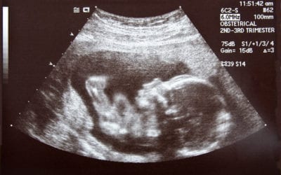 En före detta abortläkares bekännelser