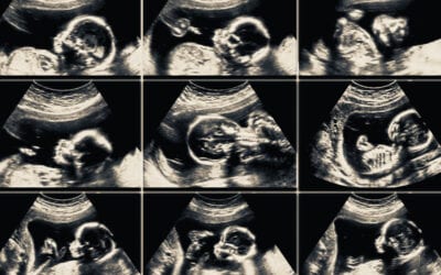 Kommentarer till Expressens reportage om abort – DEL 3 – Anmärkningsvärda påståenden från en professor