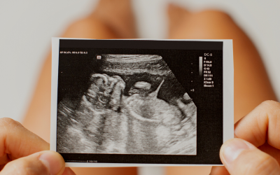 Myt 3: Liberala abortlagar minskar aborttalen