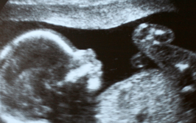 En tidigare abortläkares bekännelser