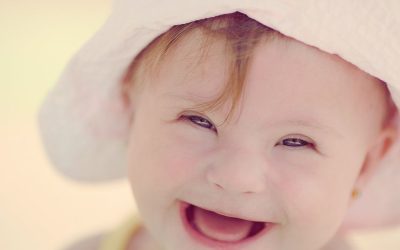 Allt färre barn med Downs syndrom även i Finland