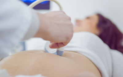 Vilseledande om Texas abortlag